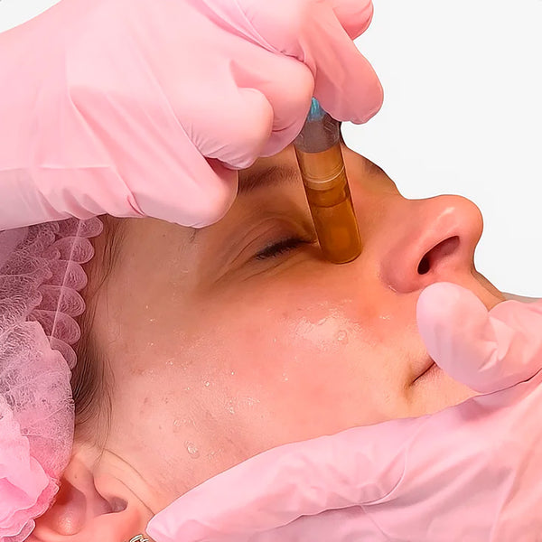 Formation certifiée CPD – Mésothérapie Non Invasive Face Fresh Vitamine